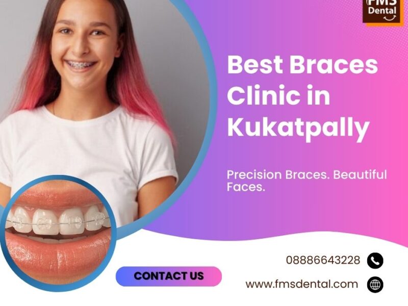 FMS DENTAL CLINICS - Kukatpally | Smile Designing | Laser Dentistry | Dental Implants