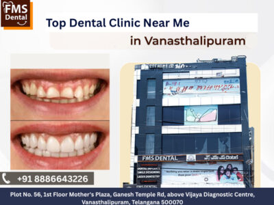 FMS DENTAL - Best Dental Clinic in Vanasthalipuram |Dental Implants | Cosmetic Dentistry | Invisalign & Aligners.
