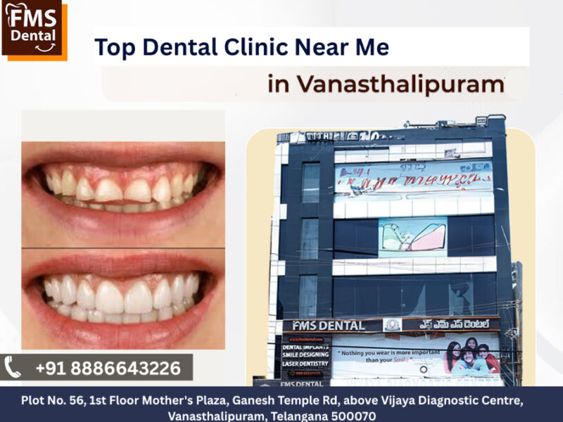 FMS DENTAL - Best Dental Clinic in Vanasthalipuram |Dental Implants | Cosmetic Dentistry | Invisalign & Aligners.