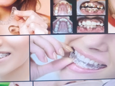 Dental Clinic in Kalyani Nagar Pune for Complete Smile CarePro