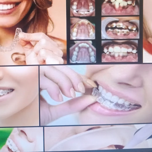 Dental Clinic in Kalyani Nagar Pune for Complete Smile CarePro